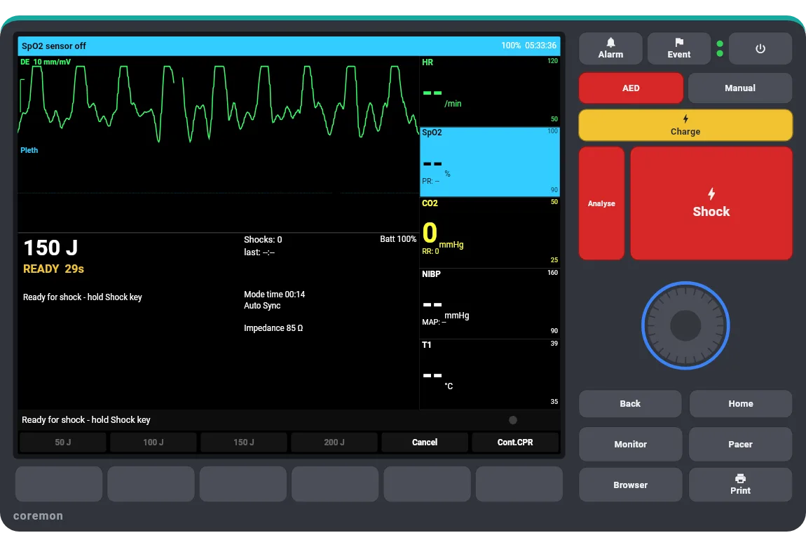 Manual defibrillation — ventricular fibrillation, 150 J ready.