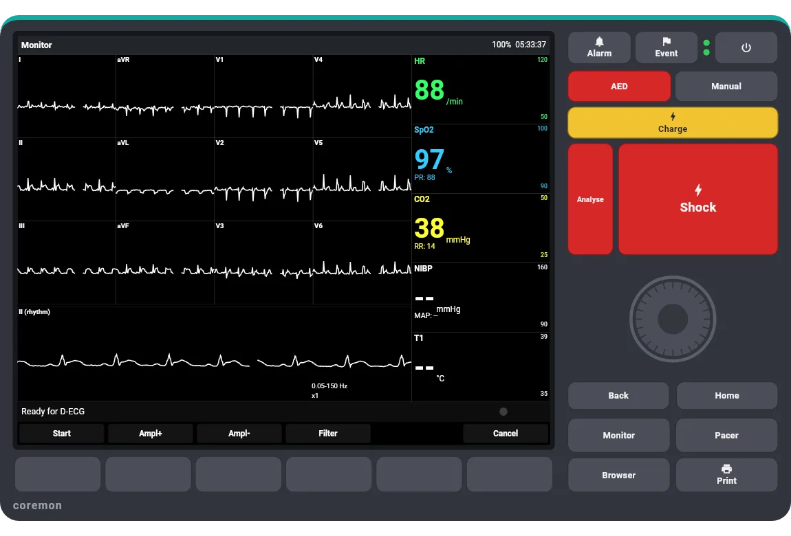 12-lead ECG preview on the device display.