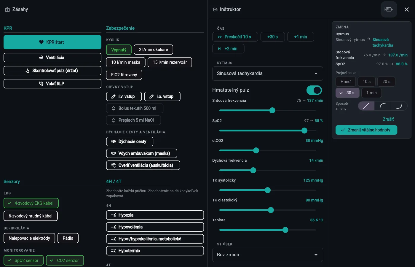 Full-screen panel — a pending change of rhythm, heart rate and SpO₂ over 30 s.